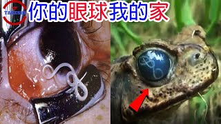 [TOP5]令人嚇破膽的眼睛寄生蟲 |小剛差點舉白旗放棄尋找的生物 | 全球第二大的失明原因