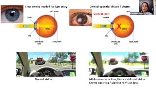 Sight + Sound Bites: Restoring Sight by Regenerating the Cornea