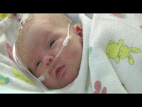 Superglue Used To Stop Newborn Baby's Brain Bleeding - YouTube