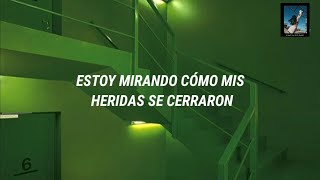 Enanitos Verdes- "La Muralla Verde"💚//Letra