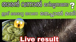 എന്ത് തേച്ചിട്ടും മാറുന്നില്ലേ? പൈസ ചിലവില്ലാതെ താരനും മുടികൊഴിച്ചലും വേരോടെ മാറ്റാം