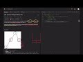 [ LeetCode 606 ] Construct String from Binary Tree | Stack | Complexity Explained | Python