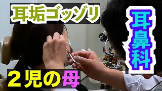 ２児の母が耳鼻科で耳垢を取りました😄まさかの…ゴッソリ！！😳