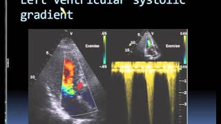 심장초음파, echo 500 해설강의 261~265