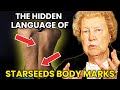 Delving into the Mysteries of 7 Starseeds Body Marks - Dolores Cannon