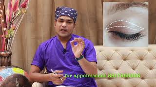 ptosis surgery /झुकी हुई पलकों की सर्जरी /ptosis treatment in Bhopal