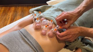 Cupping Massage for Abdominal Issues