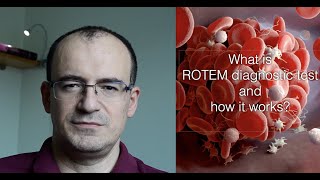 2 - What is ROTEM and how it works