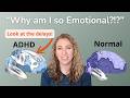 The Neuroscience of ADHD and Emotional Dysregulation