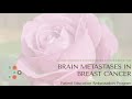 2020 PEAProgram Breast Cancer Series Patients with Brain Metastases - Prognosis & Impact on Survival