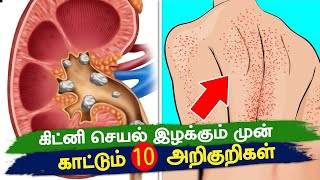 சிறுநீரக பாதிப்புக்கான  10  அறிகுறிகள்  | 10 Signs That Your Kidneys Need Help In Tamil