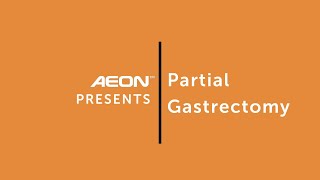 Partial Gastrectomy