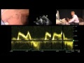 Diastolic Function — A Simple Approach