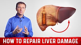How To Repair Liver Damage After Alcohol? – Dr.Berg on Liver Cirrhosis