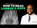 How to Read a Lumbar X-Ray