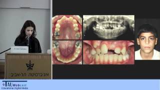 Case Presentation: Supernumerary Teeth Case