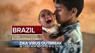 Zika Virus Cases in the United States Include 4 Pregnant Women