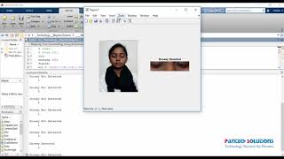 Drowsiness Detection using MATLAB