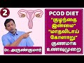 PCOD – diet plan | கருப்பை நீர்க்கட்டி / குழந்தையின்மை / மாதவிடாய் கோளாறு - உணவுமுறை | Dr. Arunkumar