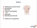 usmle rx express video of the week spleen