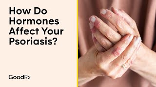 How Do Hormones Affect Your Psoriasis? | GoodRx