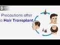 What are the precautions to be taken after hair transplant? - Dr. Nishanth Shetty