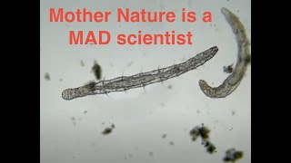 Microscopic worms and a Bursaria (Single Celled Protist)