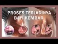 Ternyata Seperti Ini ! Proses Terjadinya Bayi Kembar