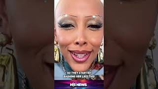 Doja Cat gets cosmetic surgery and more! 🤯 #shorts