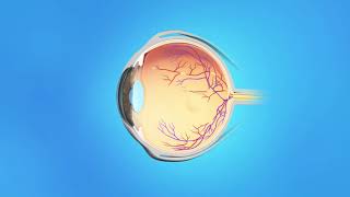 US Ophthalmic Retinal Angiography