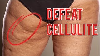 Cellfina: A Real Solution to Cellulite with No Surgery - Surgeon Minute