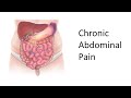 An Approach to Chronic Abdominal Pain