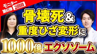 【1000億エクソソーム2回目】骨壊死と変形性膝関節症を治す再生医療【55歳女性】