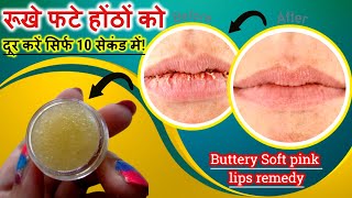 रूखे फटे होंठों का घरेलू इलाज | How To Cure Chapped Lips in Winters