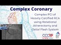 Complex PCI Heavily Calcified RCA using Rotational Atherectomy & Ostial Flash System Oct 2014 Video