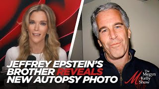 REVEALED: Never-Before-Seen Autopsy Photo of Jeffrey Epstein's Neck, with Epstein's brother Mark