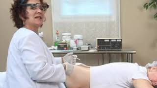 Electrolysis Buttocks Hair Removal Treatment