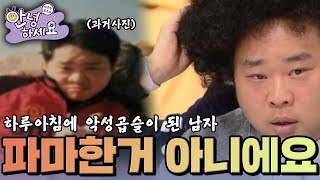 하루아침에 머리가 악성곱슬로 변한 남자  [안녕하세요] | KBS 140324 방송