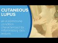 Cutaneous Lupus - Yale Medicine Explains
