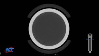 BUBBLE VOLUME USING INDUSTRIAL CT SCANNING AND VOLUME GRAPHICS