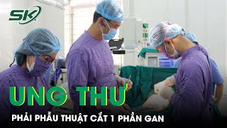 Phẫu Thuật Cắt Một Phần Gan Bệnh Nhân Ung Thư | SKĐS