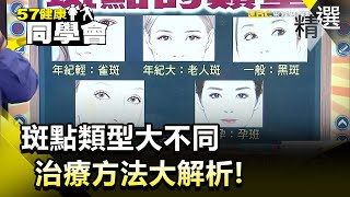 斑點類型大不同 治療方法大解析！【健康同學會】精華篇｜隋安德 許晶晶