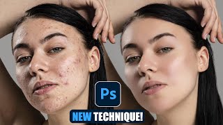 New Photoshop Trick: Perfect Skin in Minutes – Acne Gone, Smooth Skin with Simple Steps!