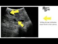 How early can you diagnose pregnancy with the XTC by ReproScan?