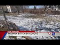 VIDEO NOW: Exeter Woman Bitten By Coyote