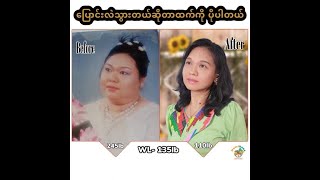 245lb မှ 110lb သို့ 135lb ဝိတ်ချ ခရီးစဉ်