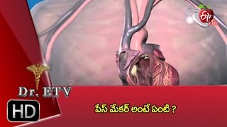 Dr ETV | Face maker for heart | 31st October 2016  డాక్టర్ ఈటివీ