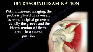 Anatomy Of The Subscapularis Muscle - Everything You Need To Know - Dr. Nabil Ebraheim