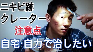 みかん肌を治したい人必見！セルフダーマペンを効率化するコツとは？