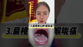 “毒王”病毒没有特效药 对症用药是关键 腺病毒 咳嗽 硬核健康科普行动  小儿肺热咳喘口服液 孩子咳嗽